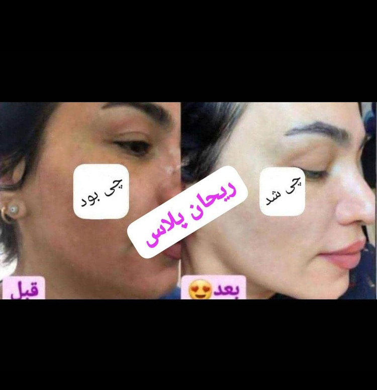 کرم ضدلک و روشن کننده ریحان پلاس